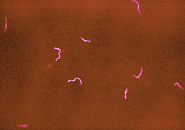 显微镜下指甲细菌图